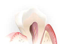 Animation of root canal
