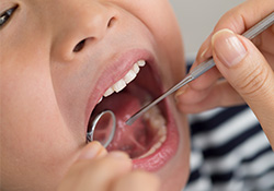 Child receiving fillings